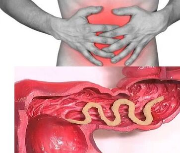 Human parasites